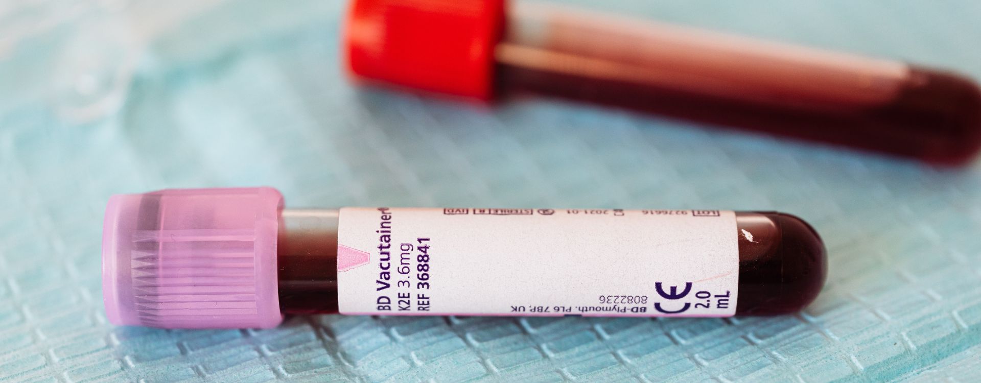PreAnesthetic Bloodwork